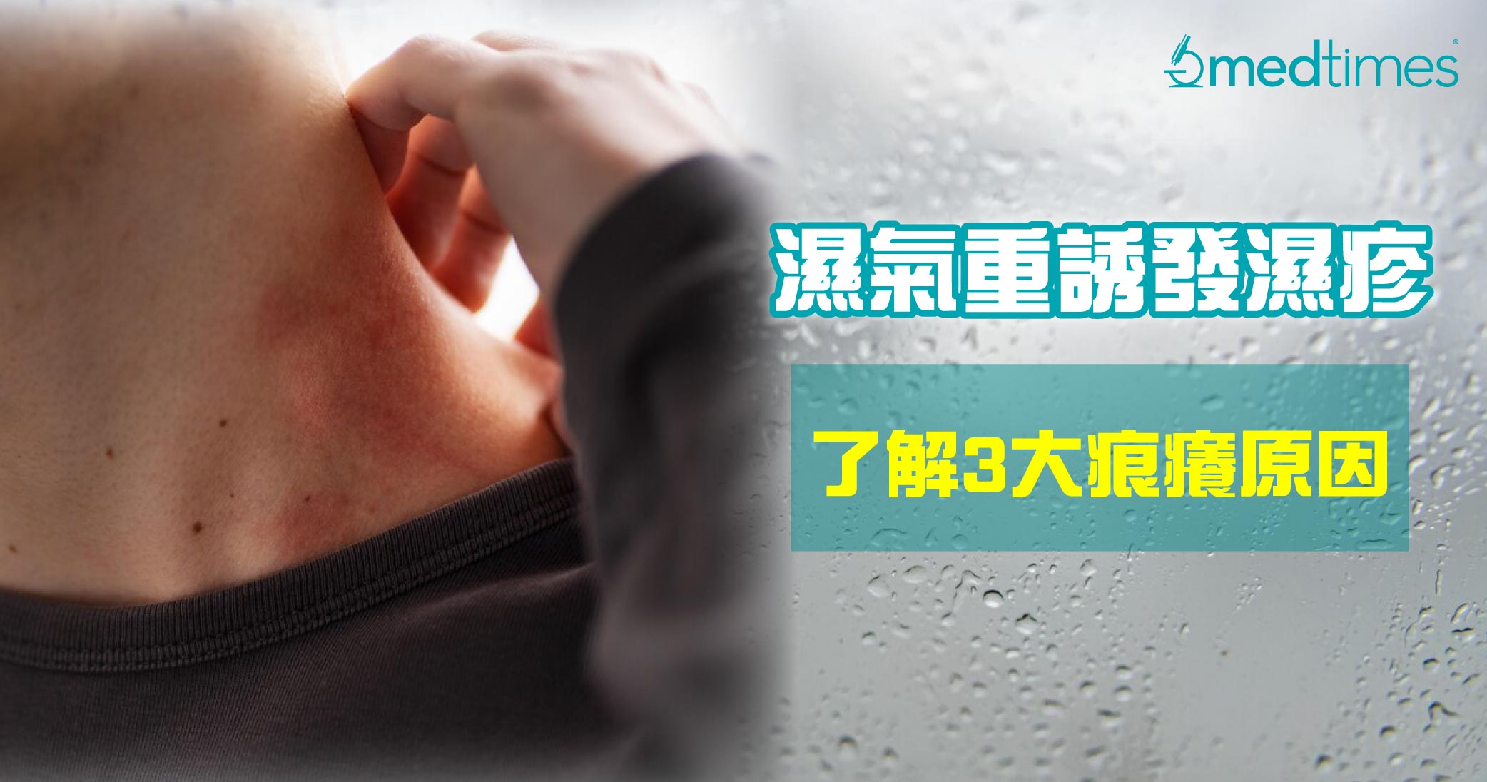 【潮湿天气】天气回暖湿气重诱发湿疹？了解春季3大痕痒原因